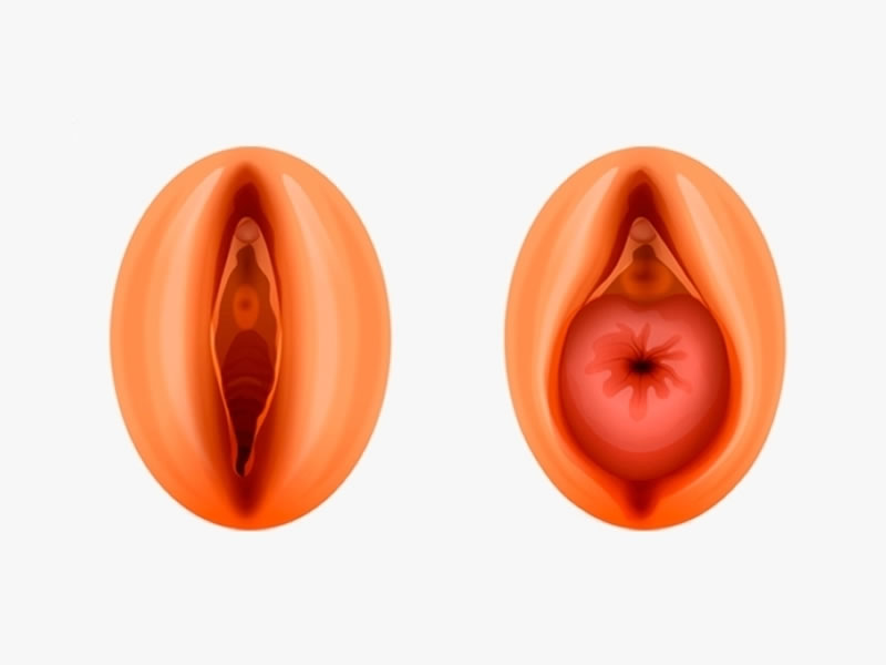 Tengo una sensación de bulto en mi vagina. ¿Qué debo hacer?